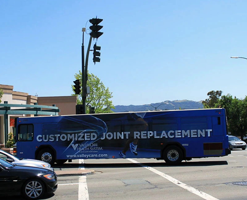 Bus Advertising, Customized Joint Replacement