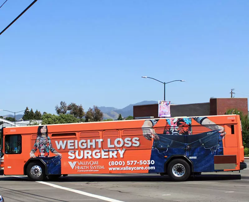 Bus Advertising, Weight Loss Surgery, Valley Care Health System